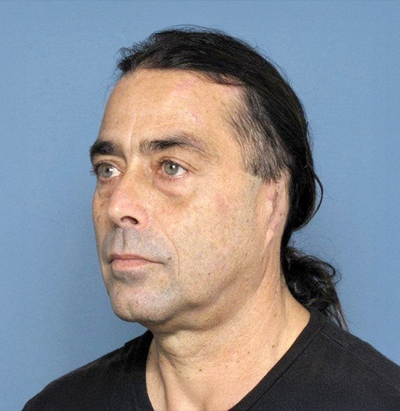 Patient with ear injury