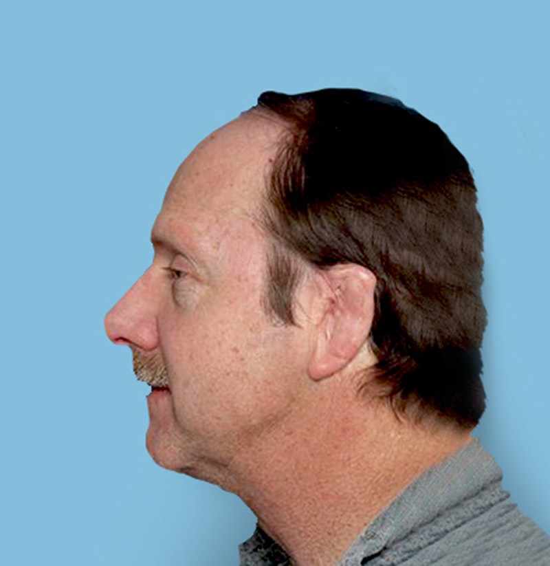 Man with injured ear