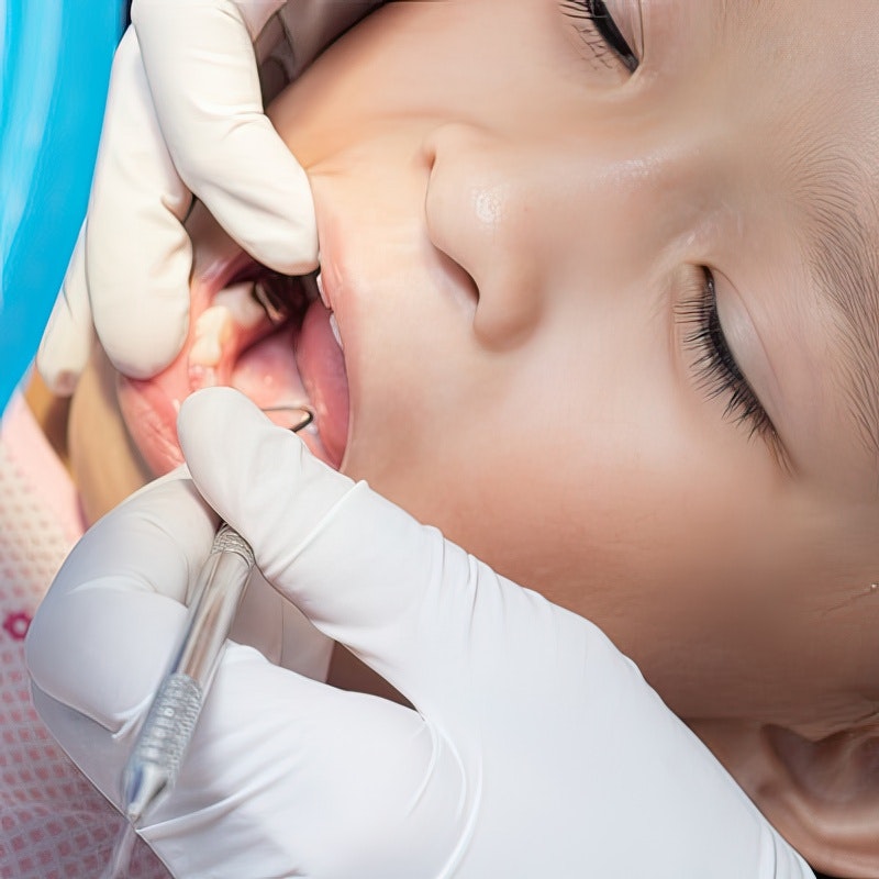 close-up of a young child getting dental work