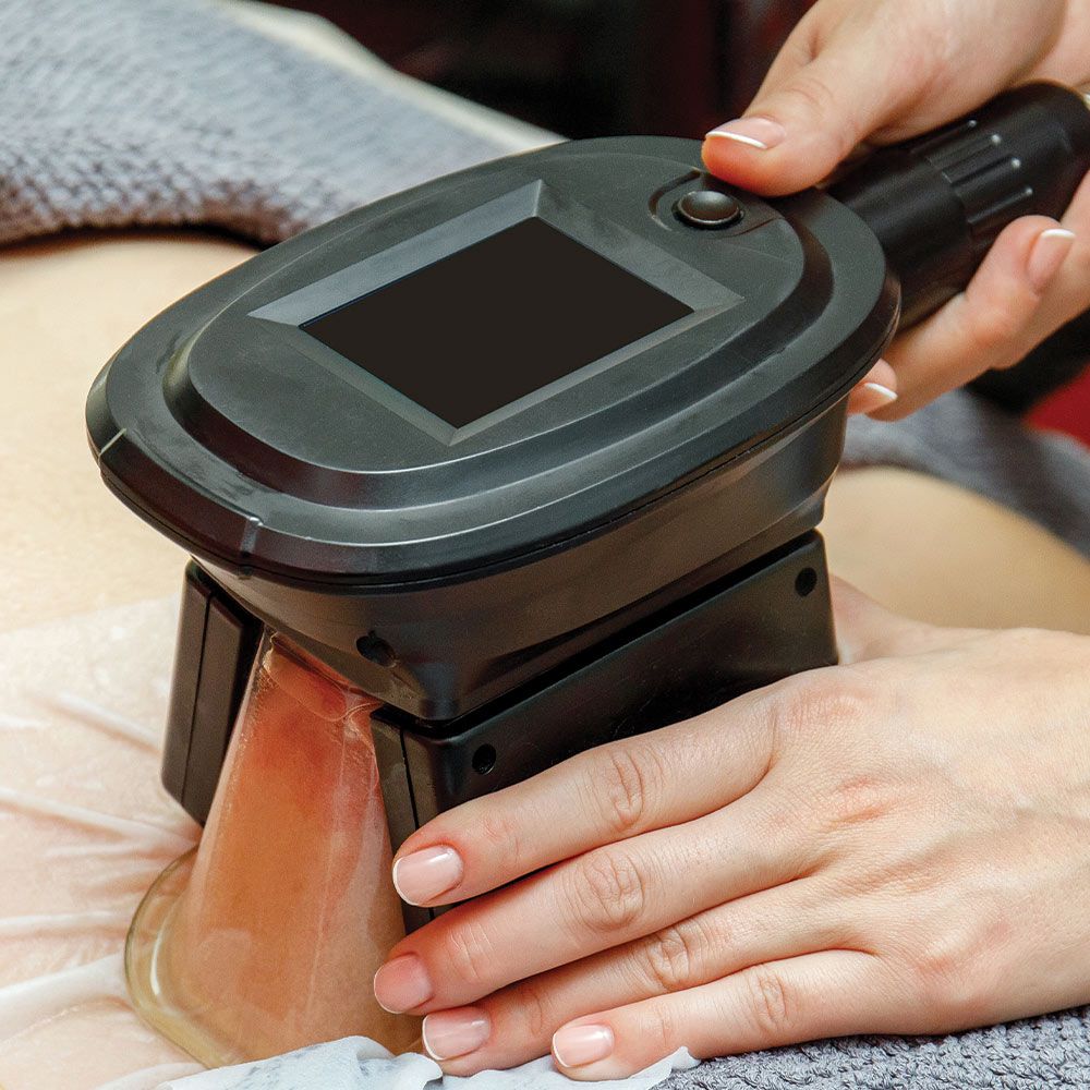 Coolsculpting treatment