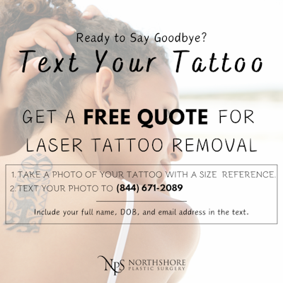 Lady with tattoo removal