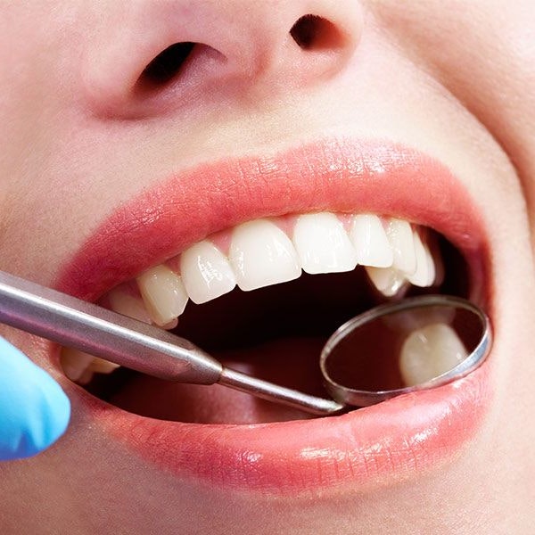 Dental mirror observing patient's mouth