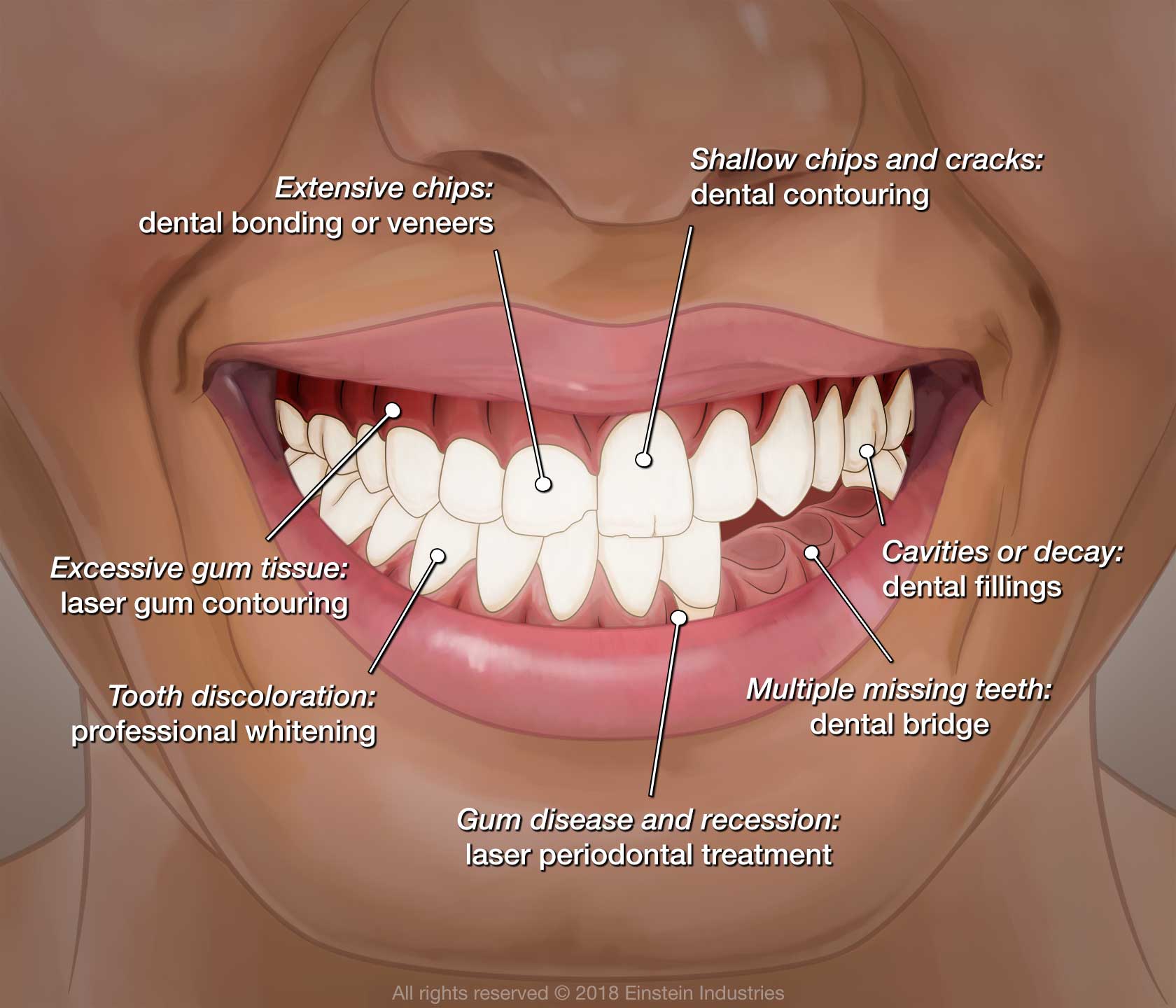 smile makeover