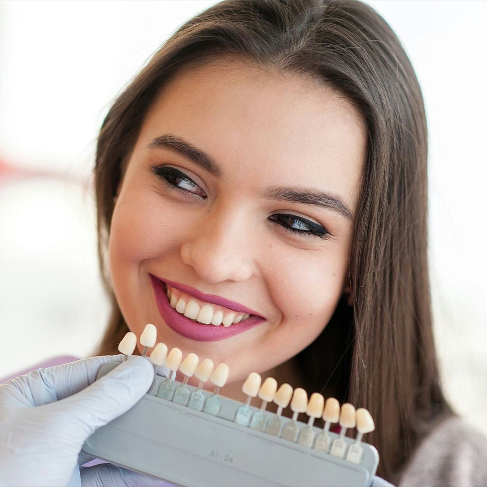 Veneer shade guide next to woman's smile