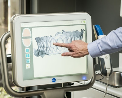 Doctor Nordhus pointing at the xray on the Itero element screen