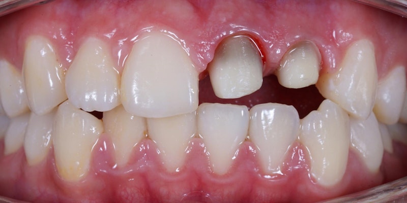 small and discolored teeth
