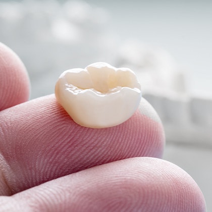 close-up of a dental crown