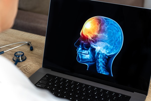 Doctor looking at a computer screen with a brain injury