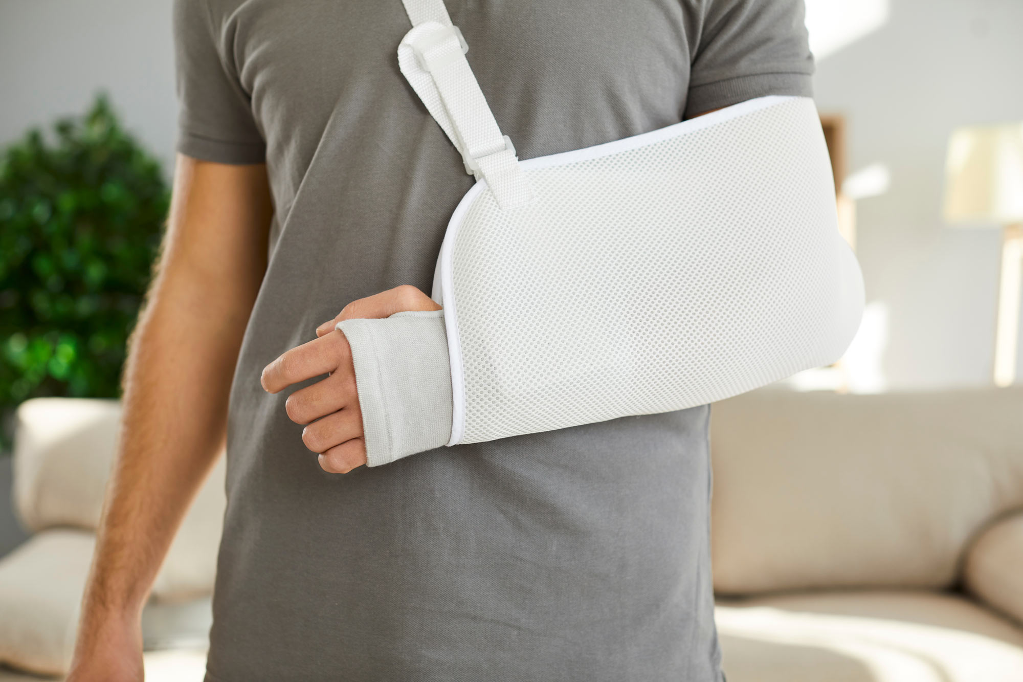 Broken arm in a cast