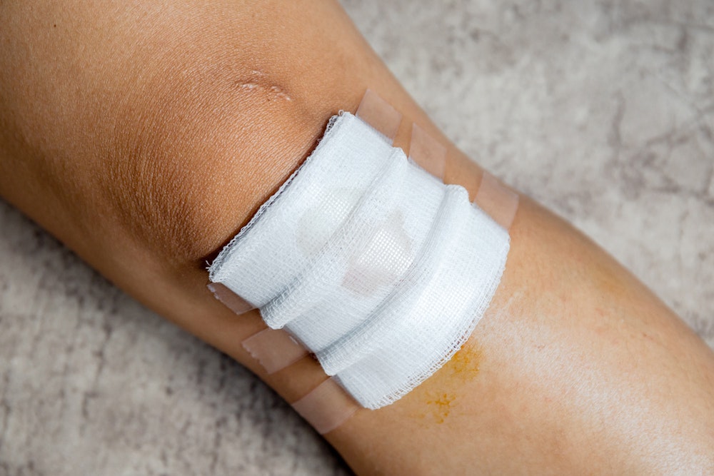 Injured knee with bandage