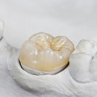 Model of teeth and dental crown