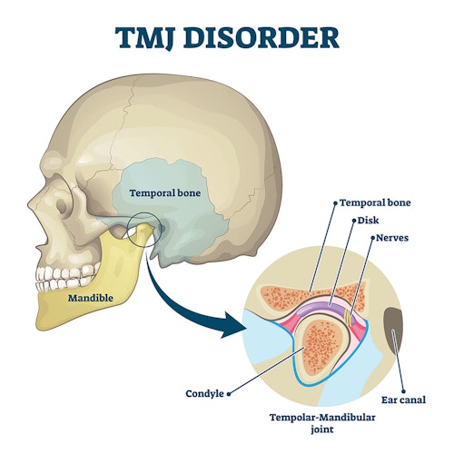 Illustration of the TMJ and its components