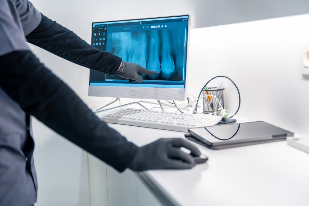 Dentist looking at scans