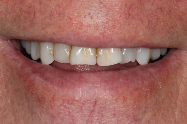 Before smile makeover