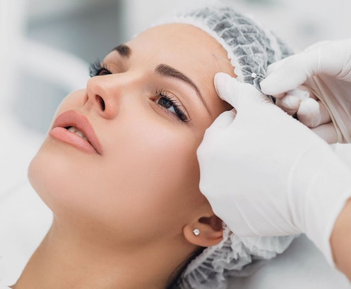 patient receiving thread lift