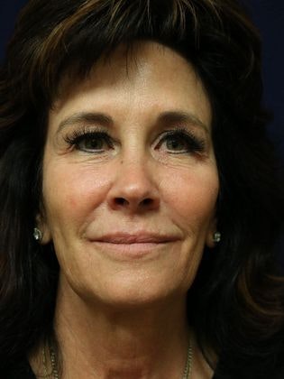 Dr. James E. Murphy's patient before Potenza