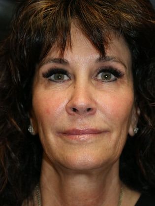 Dr. James E. Murphy's patient after Potenza