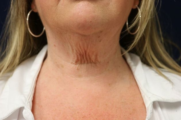 Dr. James E. Murphy's patient before Potenza