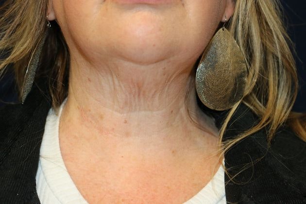 Dr. James E. Murphy's patient after Potenza