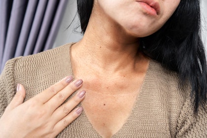Woman's wrinkled chest