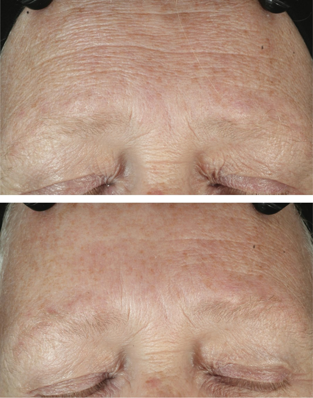 diamondglow before and after