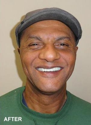 Periodontal Associates of Jackson patient smiling with perfect teeth