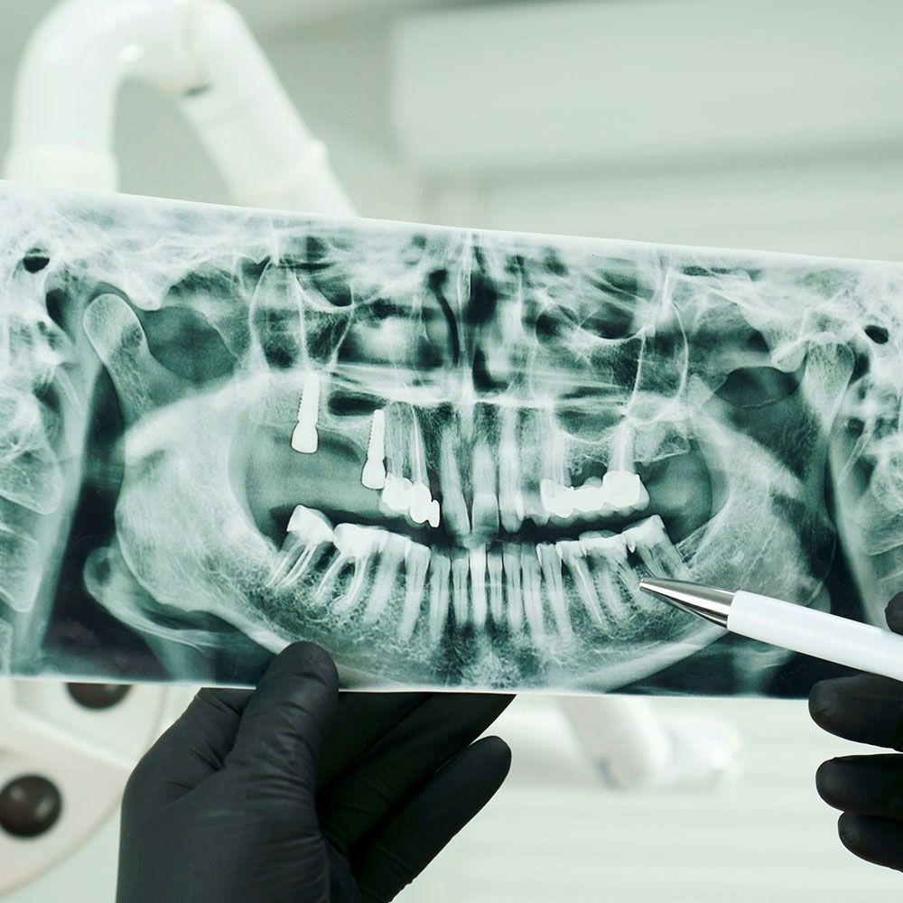 dental x-ray