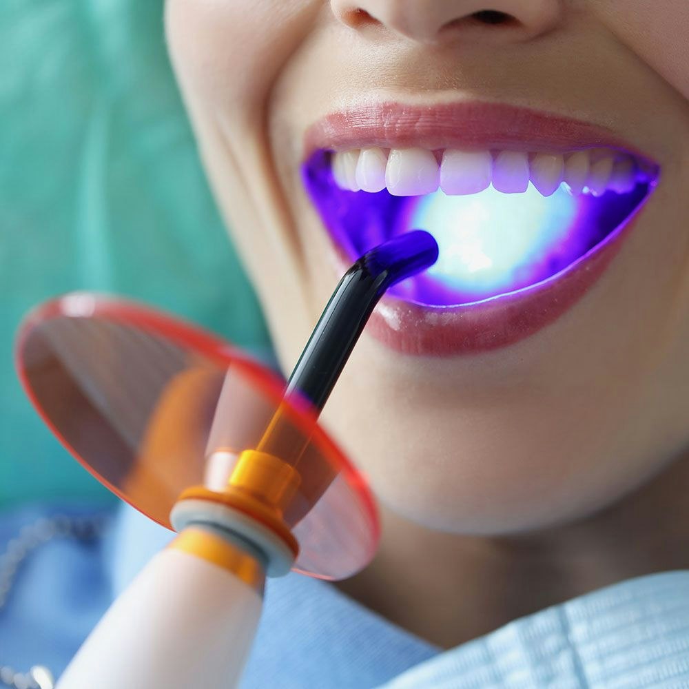 Close up of laser gum contouring