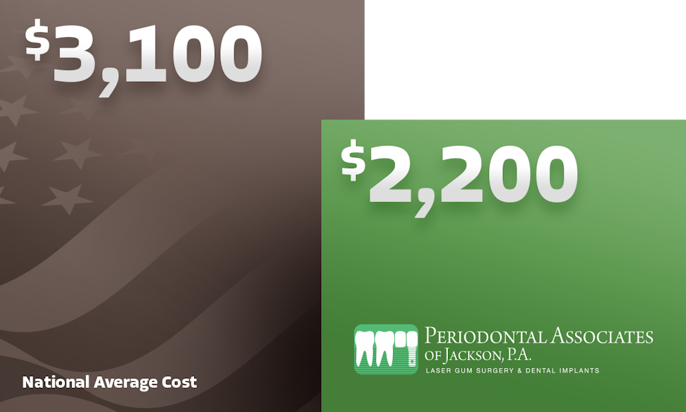 Replacing a single tooth with a dental implant costs an average of $2,200 at our practice versus a nationwide average of $3,100