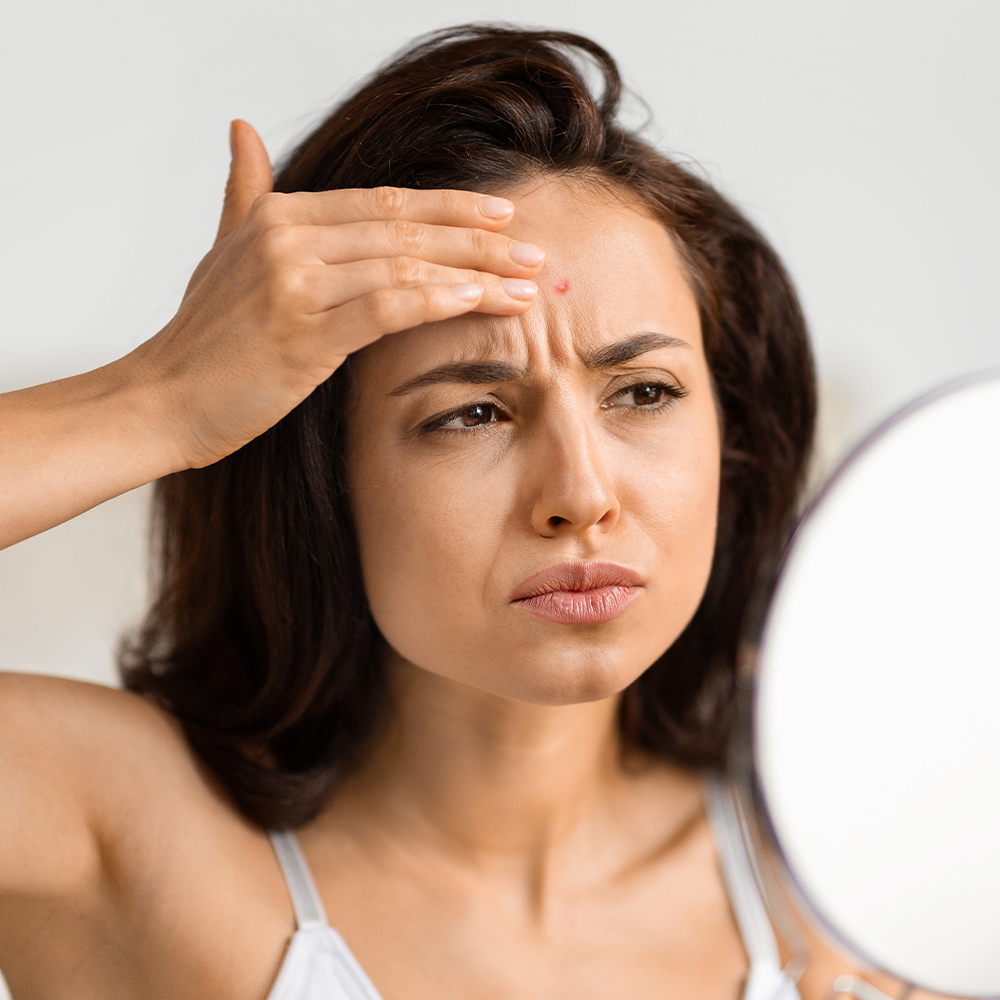 a woman examining her forehead whilst furrowing her brow