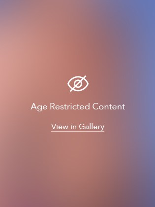 Devlin Cosmetic Surgery patient after breast augmentation