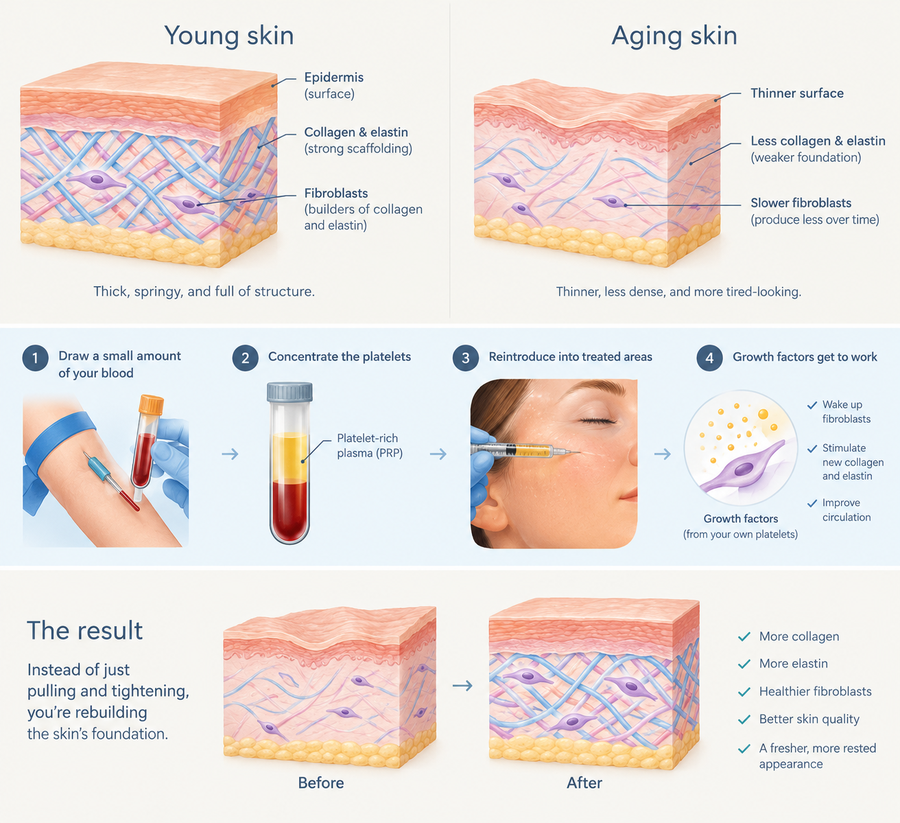 how prp works