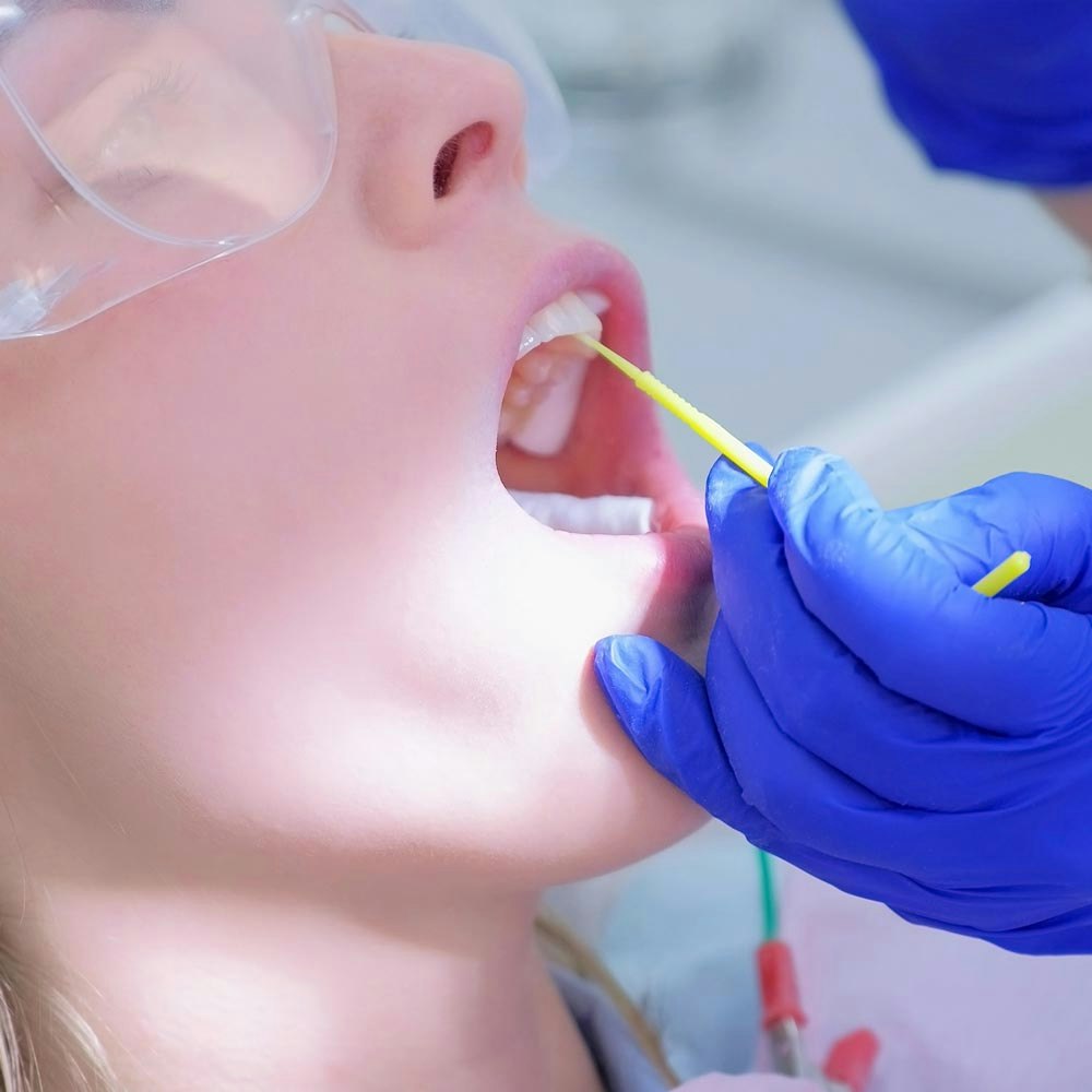 Close-Up of Patient's Mouth During Procedure