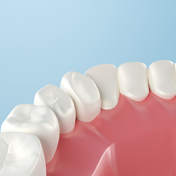 dental bonding illustration