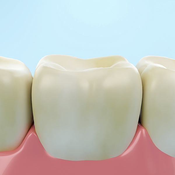 illustration of yellowed teeth