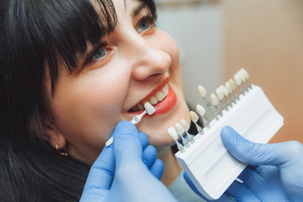Woman getting shade matched for veneers