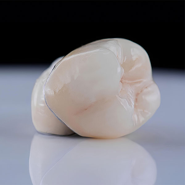 close-up of dental crowns