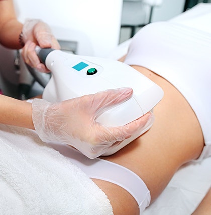 CoolSculpting treatment