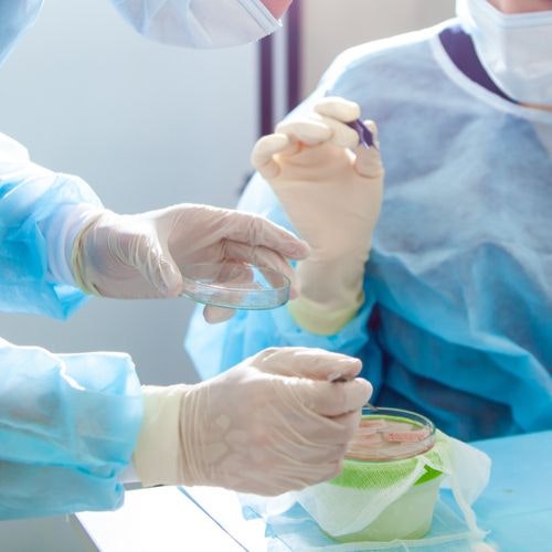 graft and tissue removal