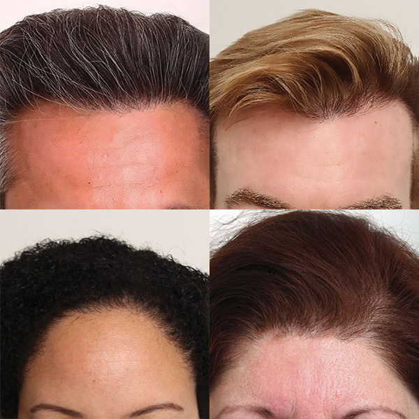 The Hair Loss Doctors: Hair Restoration Doctor NYC, NY