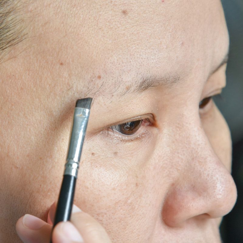 Patient with thin eyebrows