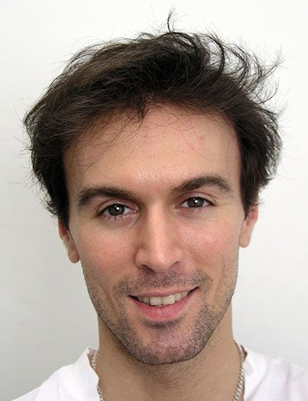 after hair restoration