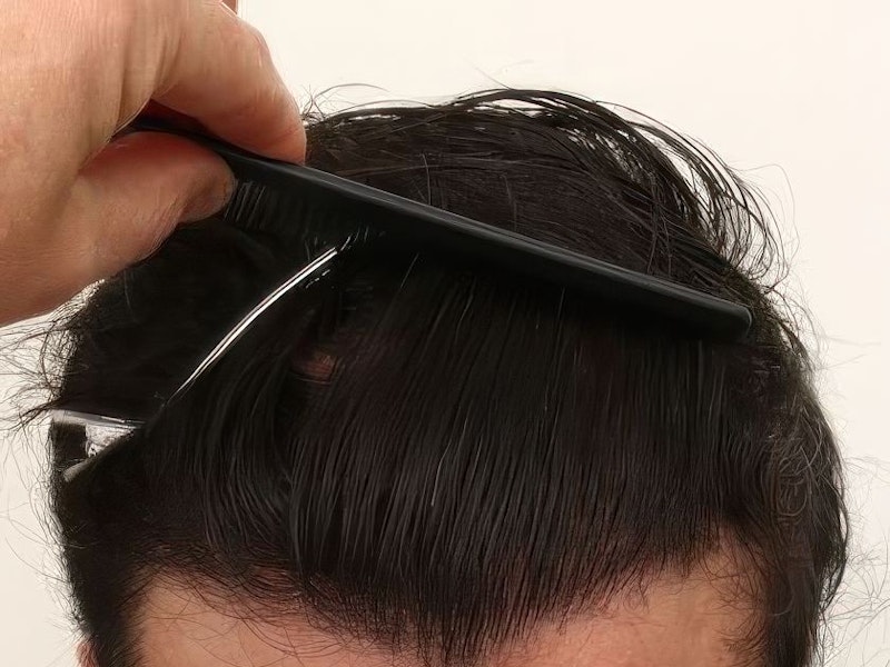 hair restoration result with comb running through hair