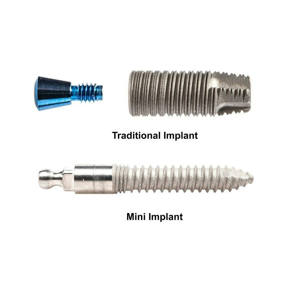 Traditional vs mini dental implant