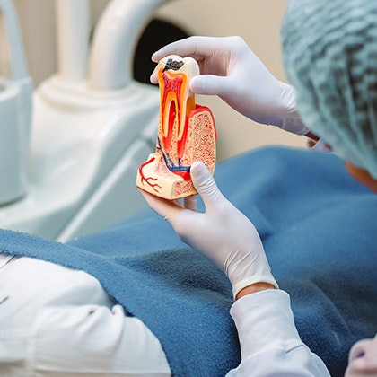 model of root canals