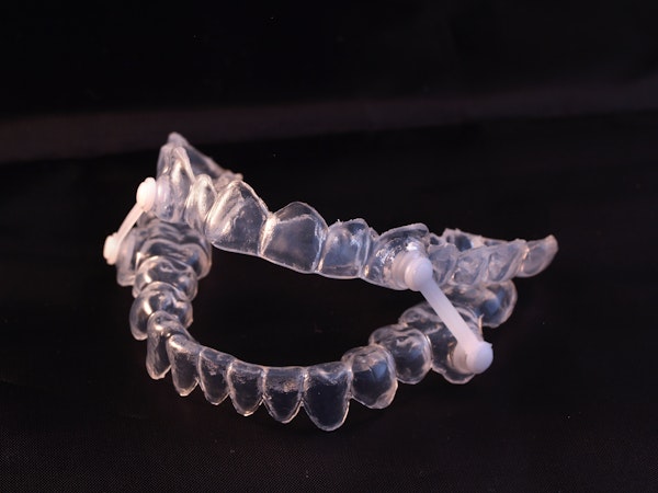 sleep apnea oral appliance