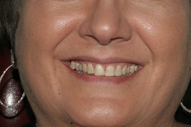 Case 5 before procedure