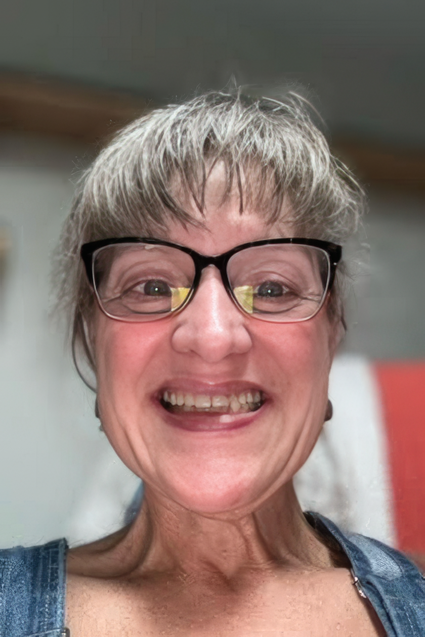 Dr. Robert's patient before a smile makeover