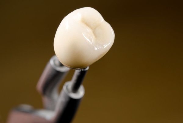 Photo of a dental crown