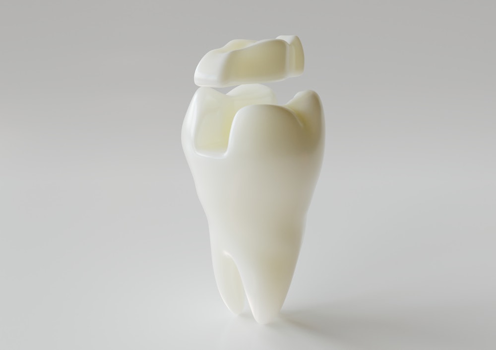 Photo of a CEREC milling unit